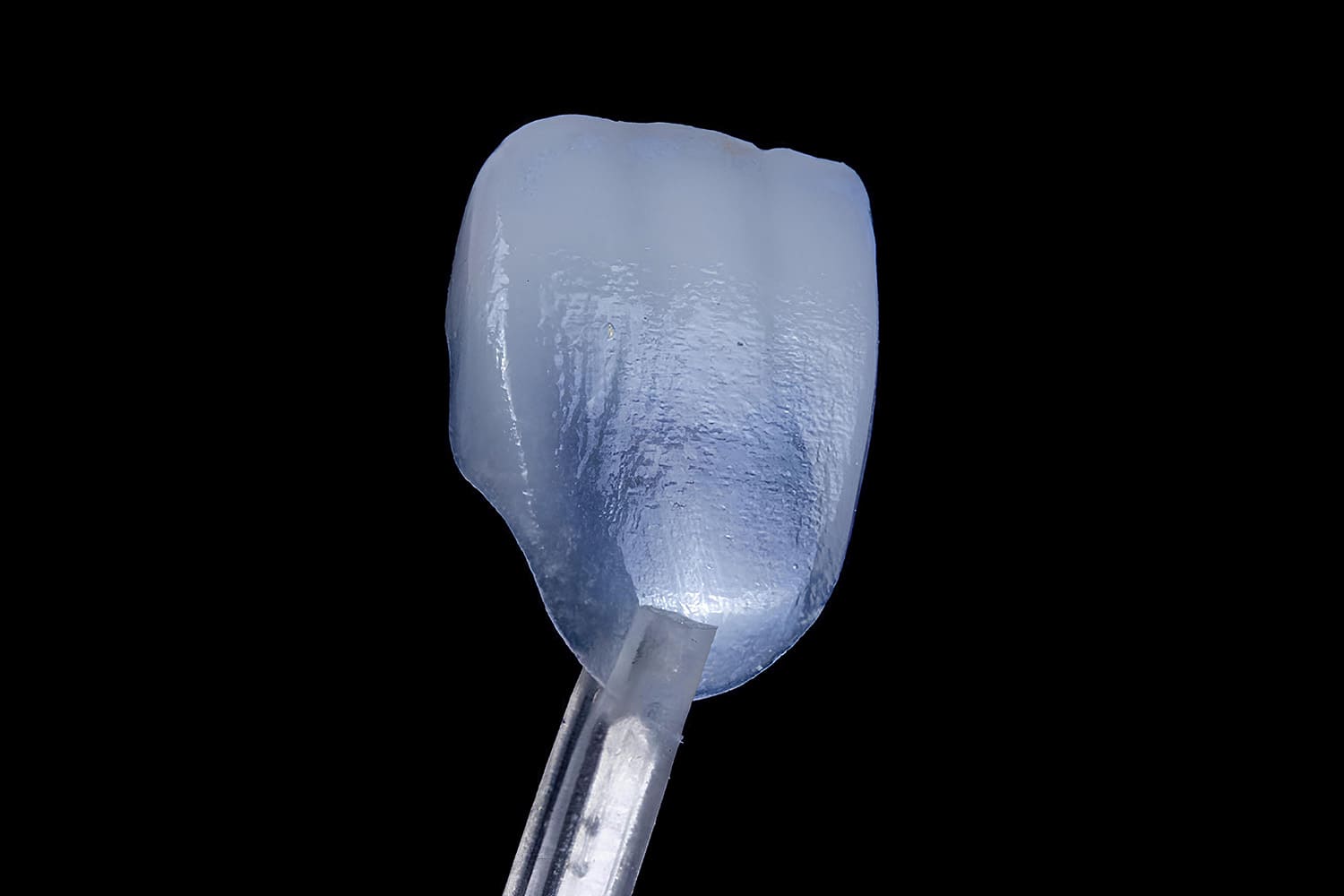 ラミネートベニア