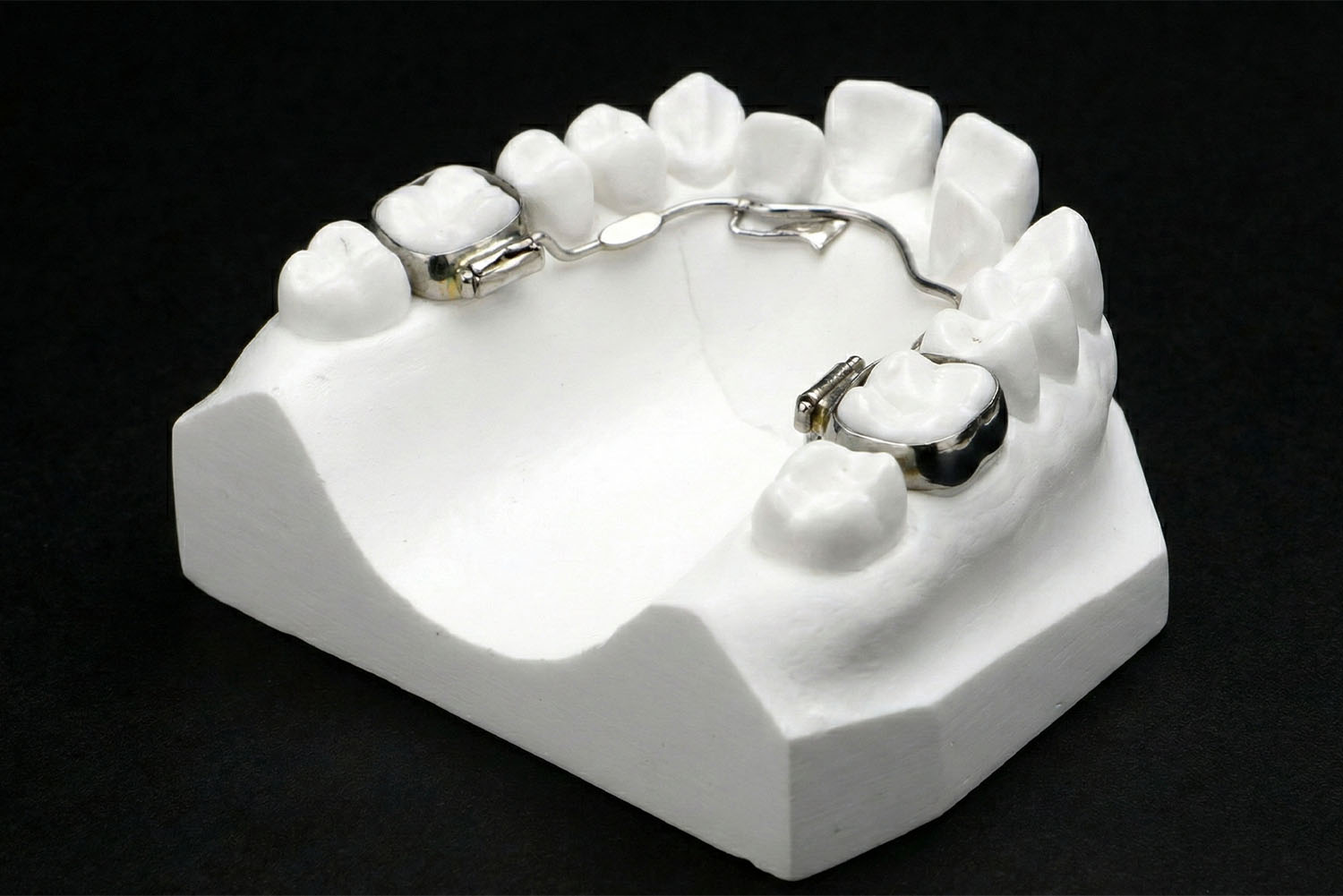 リンガルアーチ