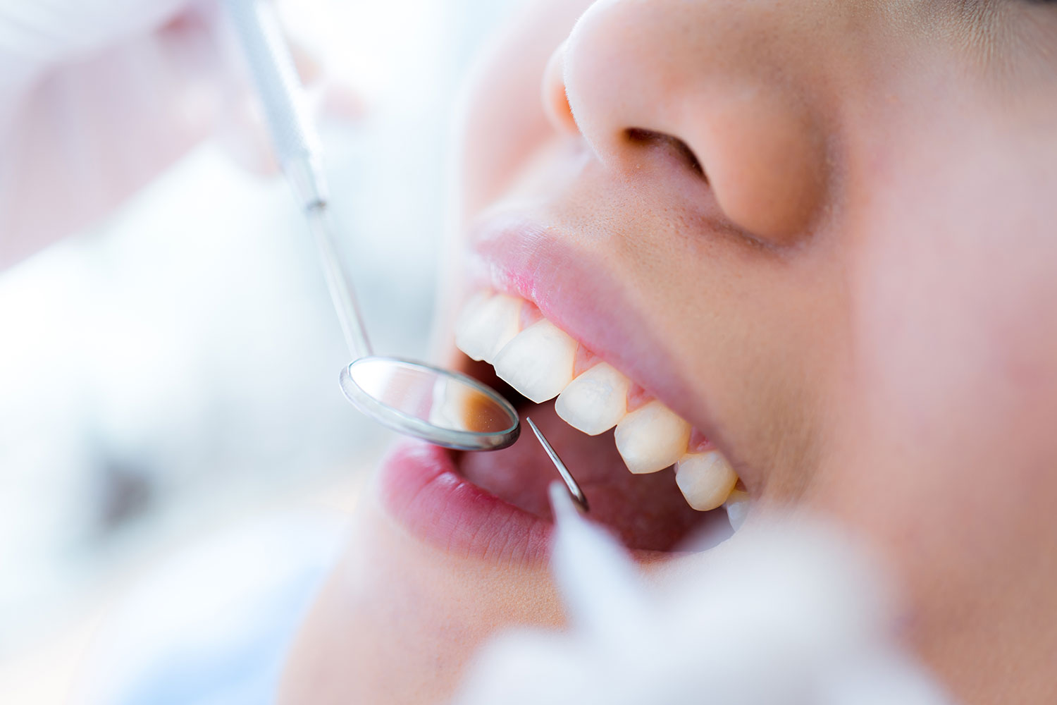 予防歯科の重要性