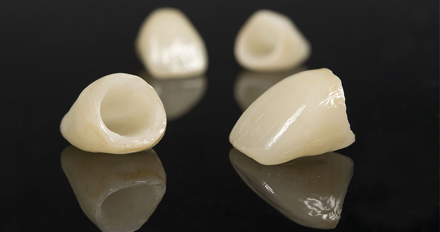 神経まで進行した虫歯