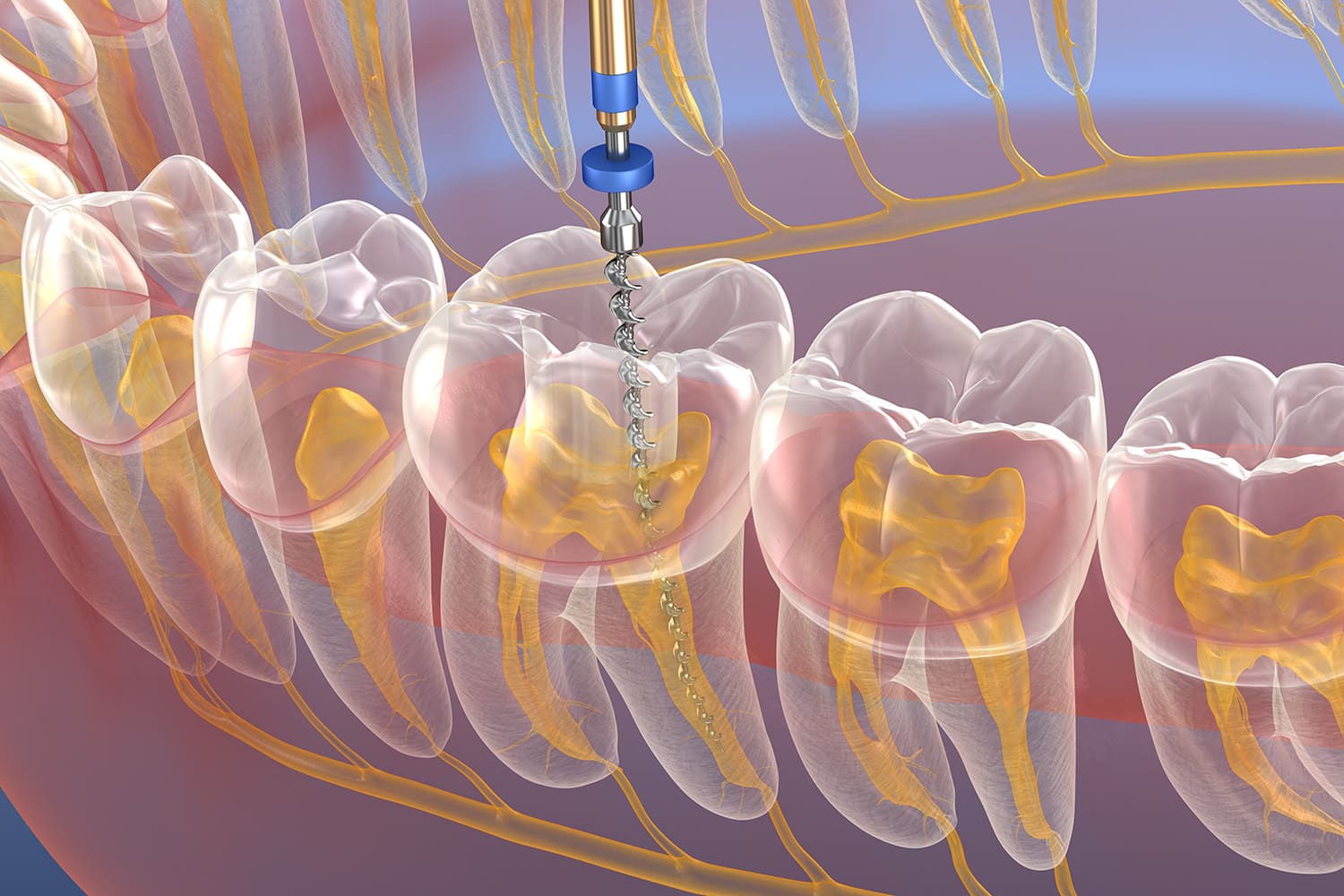 保健治療の場合