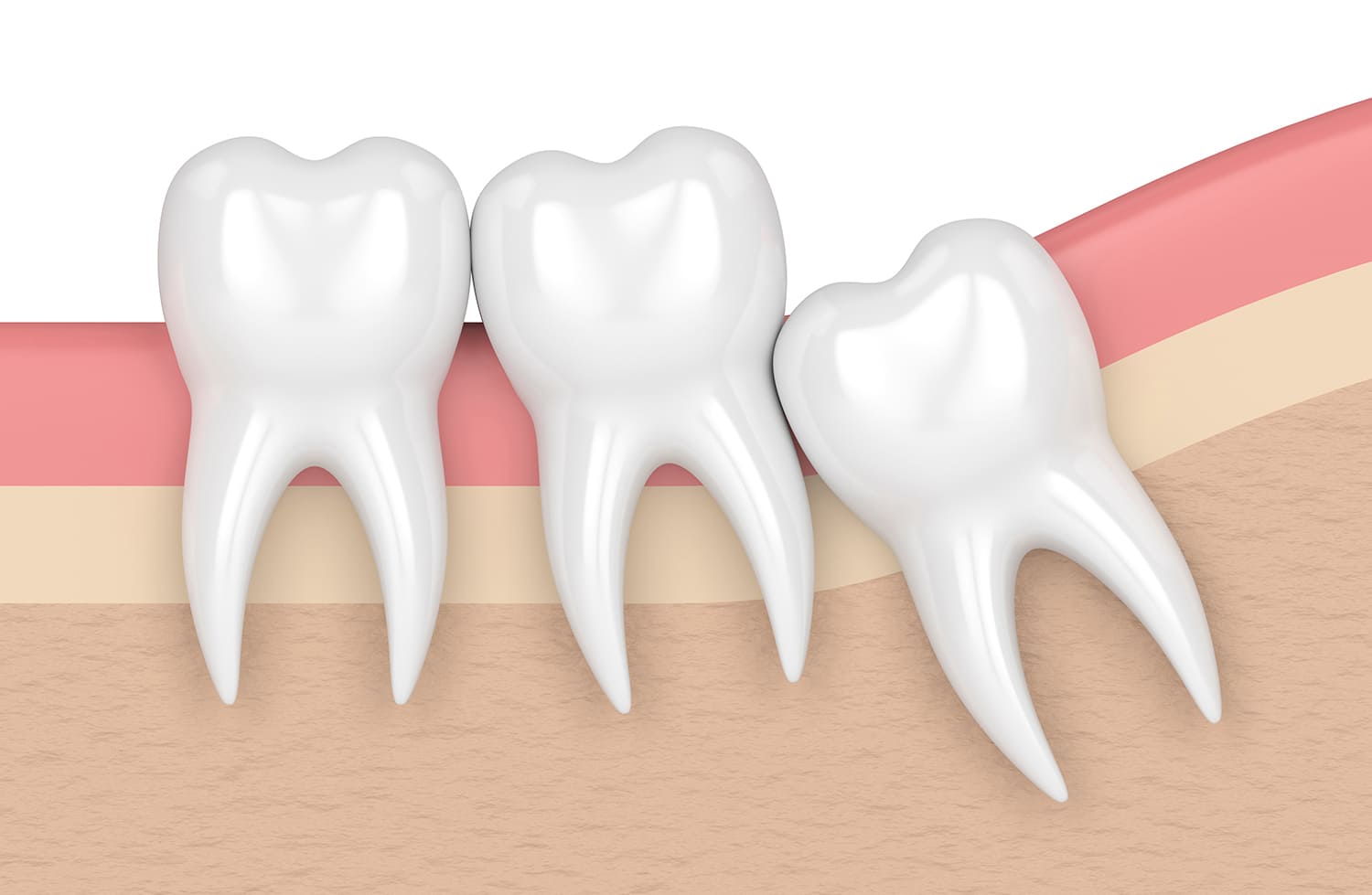 親知らずとは？